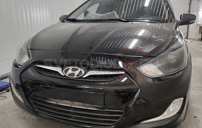 Установка омывателя фар Hyundai Solaris 10